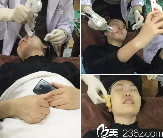 水光注射过程 水光注射过程