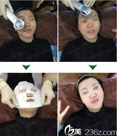 术后的镇痛管理敷医用面膜 术后的镇痛管理敷医用面膜