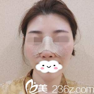 手术后第3天 手术后第3天