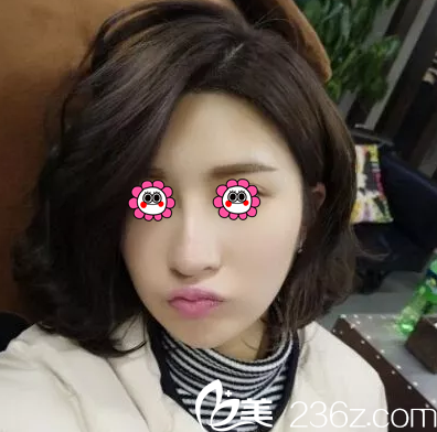 北京华韩面部吸脂