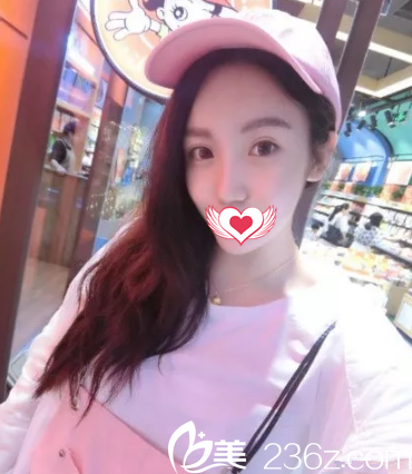 术前胸部平坦 术前胸部平坦