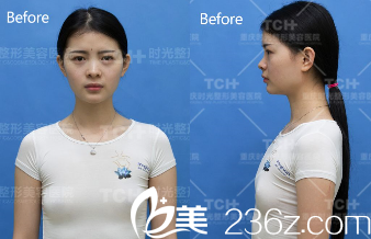 去重庆时光面诊的小婴 去重庆时光面诊的小婴