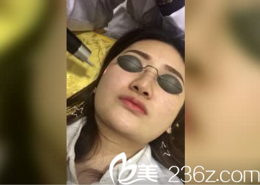 <!--<i data=20240703-sp></i>-->激光祛斑效果好不好 <!--<i data=20240703-sp></i>-->激光祛斑效果好不好