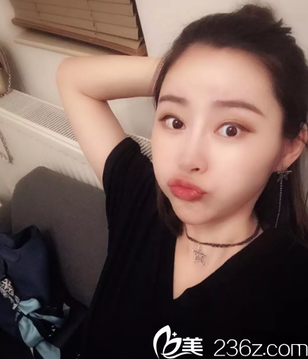 这个时候已经美美哒的了 这个时候已经美美哒的了