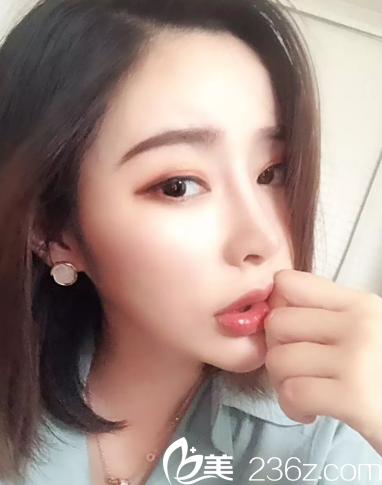 半年过去了,完全是个正常人了 半年过去了,完全是个正常人了