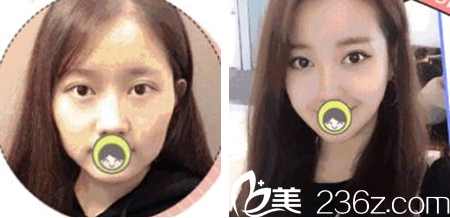 <!--<i data=20240703-sp></i>-->谁做线雕好 <!--<i data=20240703-sp></i>-->谁做线雕好