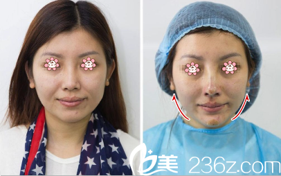 贵州做面部线雕好的医生是哪个 贵州做面部线雕好的医生是哪个