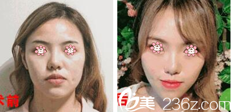 汪国应线雕案例 汪国应线雕案例