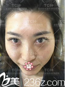 手术后天的森女士