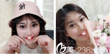 半年后的森女士