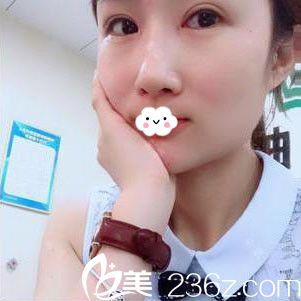 随州奥莱切开双眼皮+开内眼角效果怎么样 随州奥莱切开双眼皮+开内眼角效果怎么样