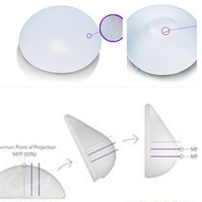 赵镕贤院长假体隆胸分类