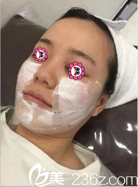 在北京华韩做热玛吉美肤面部敷麻样子 在北京华韩做热玛吉美肤面部敷麻样子