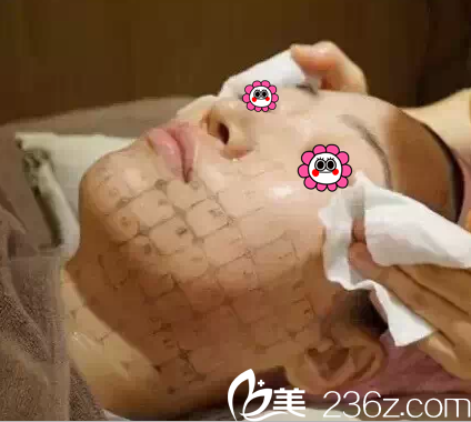 北京华韩邢志花医生给我做热玛吉美肤治疗中 北京华韩邢志花医生给我做热玛吉美肤治疗中