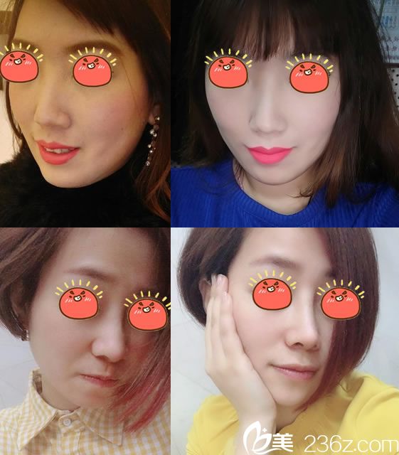 宁波薇琳黄荣案例 宁波薇琳黄荣案例