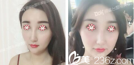 重庆铜雀台宋居财祛痘案例