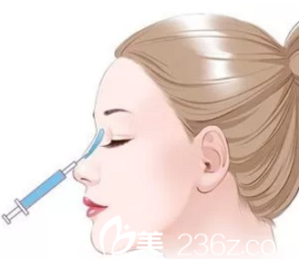 注射隆鼻能维持多久？