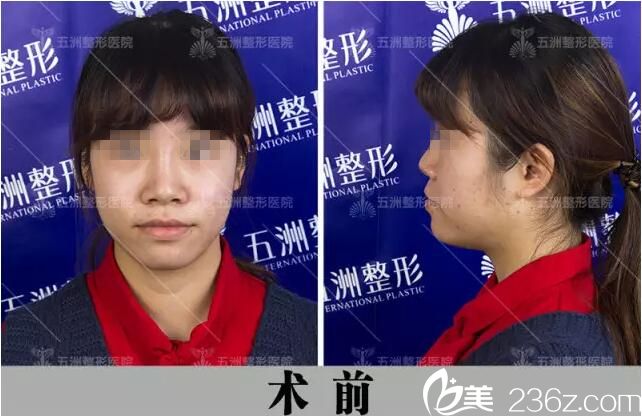 术前照片 术前照片