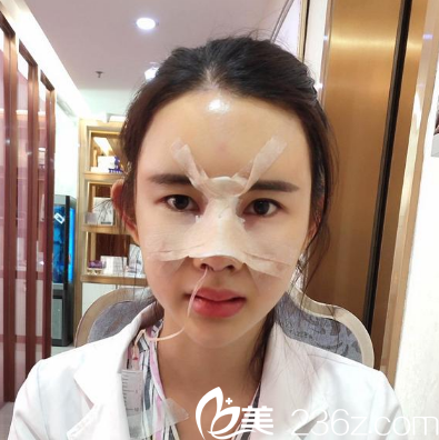 深圳妍熙陈桂飞鼻修复术后3天
