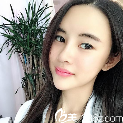 深圳妍熙陈桂飞做的鼻修复7天效果图