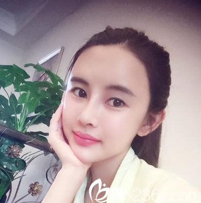 深圳妍熙陈桂飞鼻修复案例半个月效果图