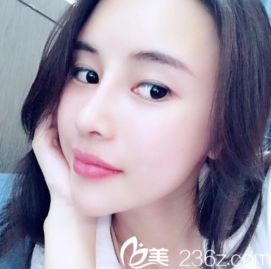 深圳妍熙陈桂飞做的隆鼻失败修复案例