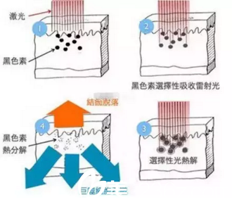激光祛斑原理