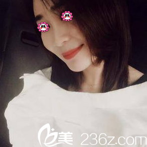 我在北京亚韩做V塑加面部脂肪填充第48天效果 我在北京亚韩做V塑加面部脂肪填充第48天效果