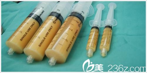 自体脂肪的存活率与哪些因素有关