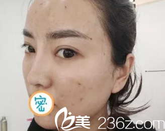 我的脸真的是脏到一种境界