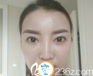 为在烟台做个自体脂肪填充面部手术，我快跑完所有医院了