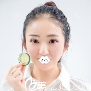 阜阳东方美莱坞双眼皮失败修复术后2个月
