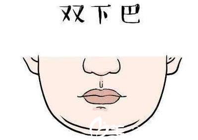 双下巴图例