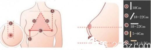 自体脂肪隆胸优势