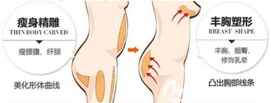 自体脂肪隆胸能被吸收多少？