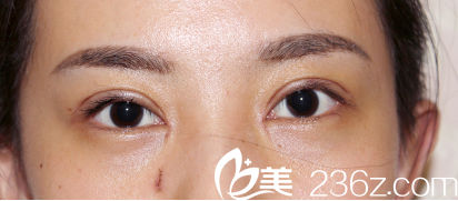 恢复的特别快 恢复的特别快