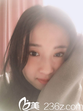 距离我在潍坊华美做全切双眼皮整形已经三个月了，分享我的恢复过程