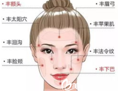 自体脂肪可填充部位展示图