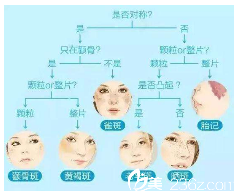 斑点种类不通，价格不同