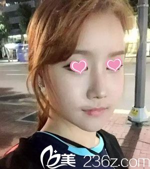 术后28天 术后28天