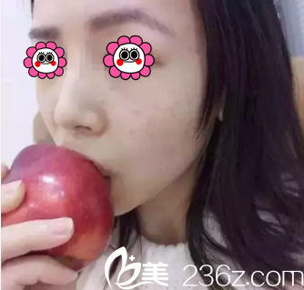 高艳医生给我注射第12天效果 高艳医生给我注射第12天效果