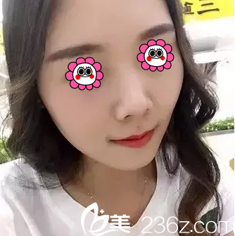 北京米兰柏羽丽都注射案例 北京米兰柏羽丽都注射案例