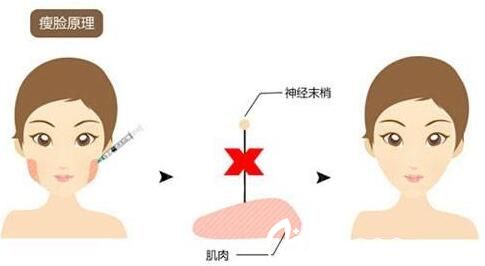 打瘦脸老了有什么影响
