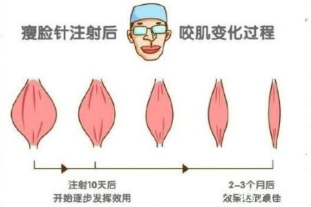 打瘦脸不良影响：使用不当
