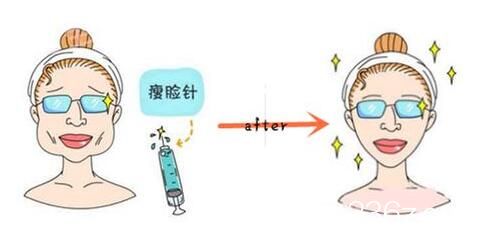 打瘦脸不良影响：瘦脸品质有关