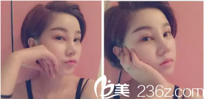 现在的眼睛还是依然的肿着 现在的眼睛还是依然的肿着