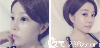 鼻子还是挺好的 鼻子还是挺好的