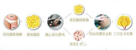  脂肪是怎么成活的呢？