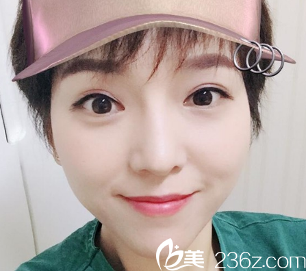 这是我恢复30天后的样子