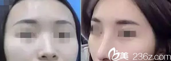 芳艺整形杨伟主任<span style= 芳艺整形杨伟主任<span style=